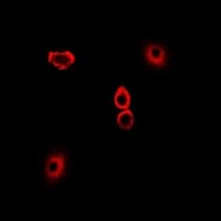 Polyclonal Rabbit anti-Human TRP32 / TXNL1 Antibody (IHC, IF, WB)