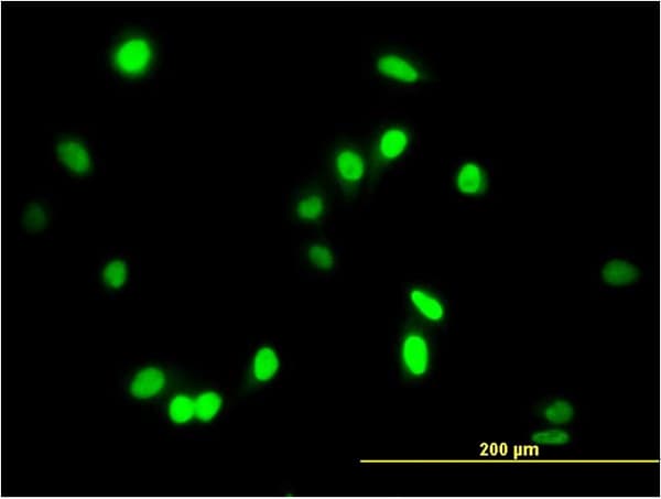 IHC-plus™ Monoclonal Mouse anti-Human AATF Antibody (clone 3C7, IHC, IF, WB)