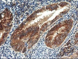 TFG Antibody (clone OTI2C3)