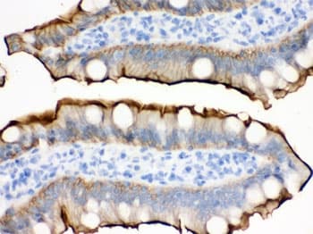 Polyclonal Rabbit anti-Human VIL1 / Villin Antibody (IHC, WB)