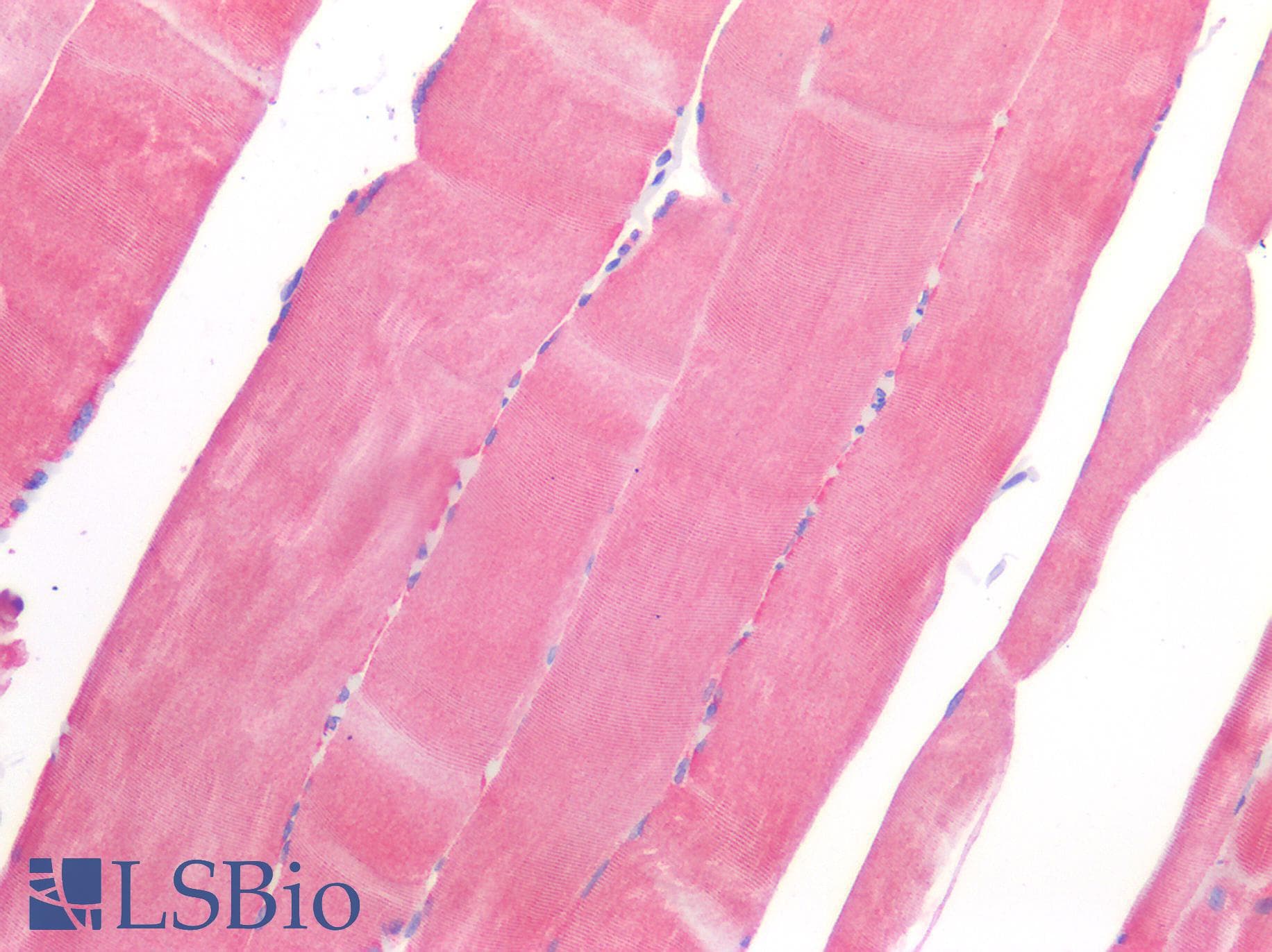 IHC-plus™ ROR1 Antibody (Internal Region)