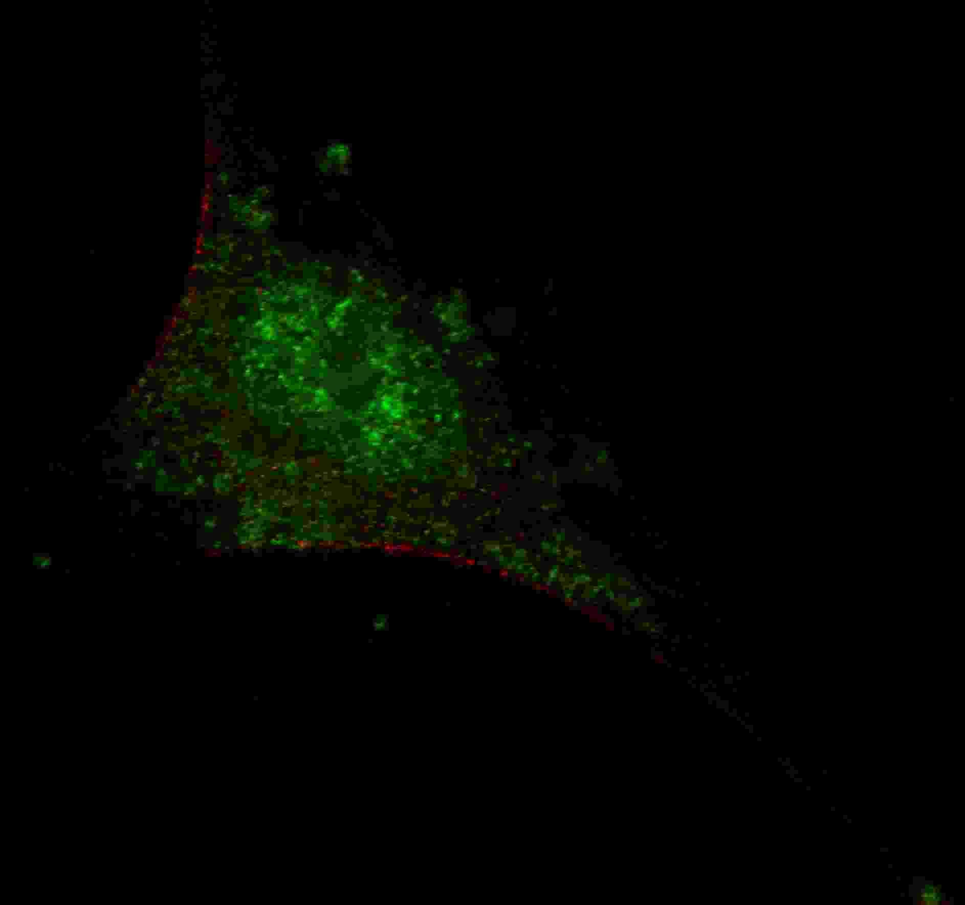 IHC-plus™ Polyclonal Rabbit anti-Human SMAD2 Antibody (Thr220, IHC, IF, WB)