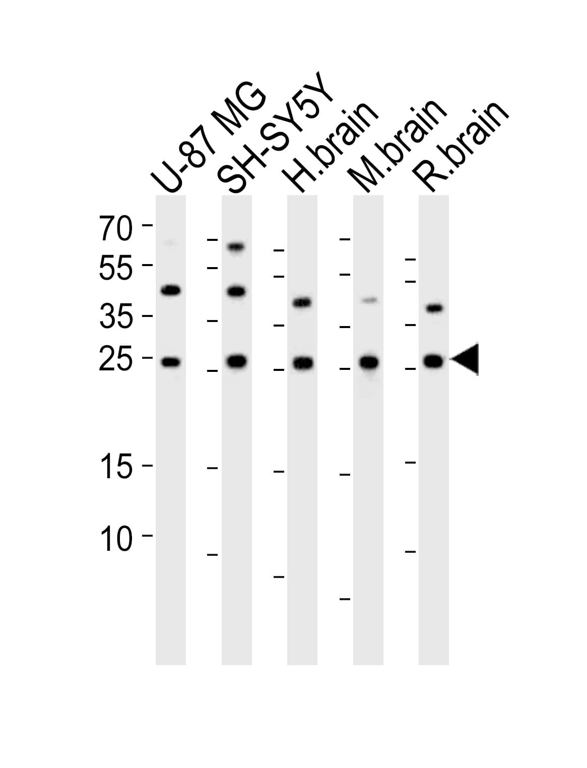 SCG10 / STMN2 Antibody (aa36-69)