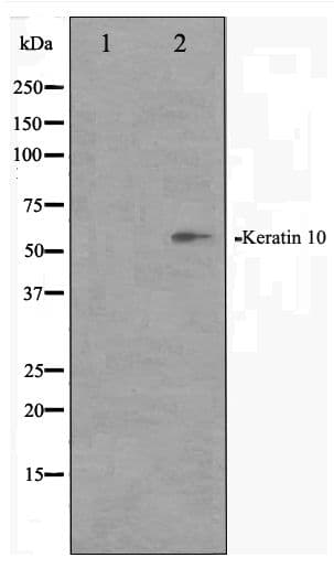 KRT10 / CK10 / Cytokeratin 10 Antibody
