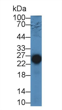 TNNI2 Antibody (aa1-182)