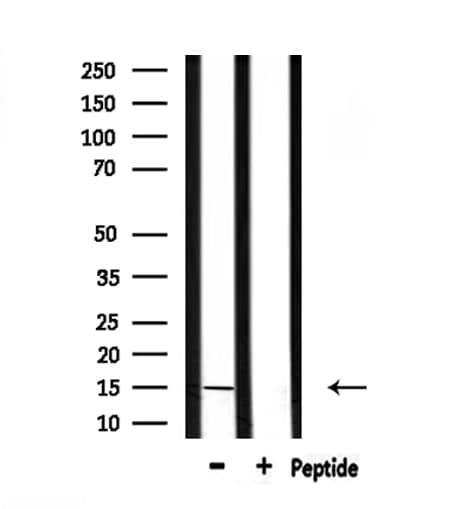 Polyclonal Rabbit anti-Human KISS1 / Kisspeptin / Metastin Antibody (IHC, IF, WB)