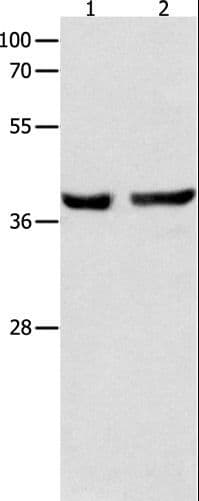 SERPINB5 / Maspin Antibody