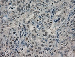 Monoclonal Mouse anti-Human LDHA / LDH1 Antibody (clone OTI2D11, IHC, WB)