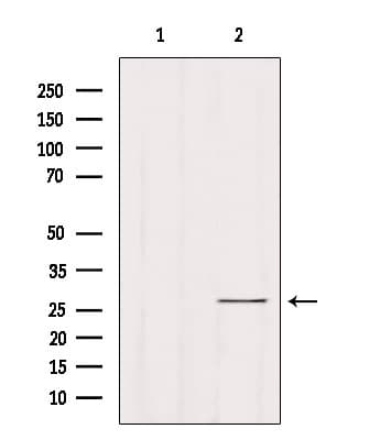 Polyclonal Rabbit anti-Human RAB33B Antibody (IHC, WB)