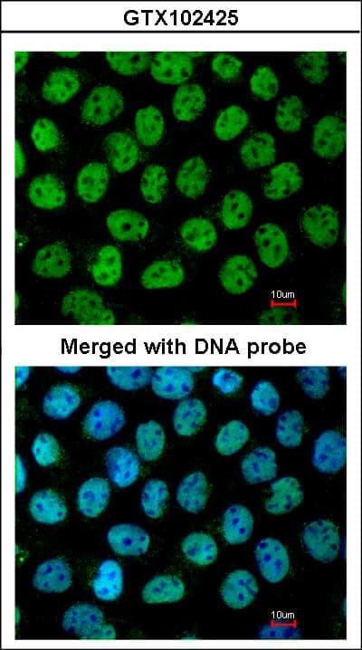 TP63 / p63 Antibody (aa125-415)