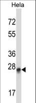 Polyclonal Rabbit anti-Human PEX19 Antibody (aa33-61, WB)