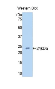 TLR2 Antibody (aa47-245, Biotin)