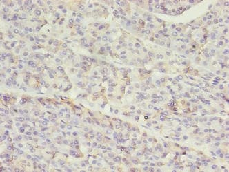 SETD7 / SET7 Antibody