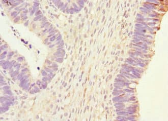 PHKG2 Antibody