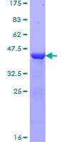 Human CRABP1 / CRABP Protein (Recombinant GST)