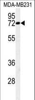 MCMBP / C10orf119 Antibody (aa143-171)