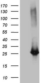 EXOSC1 / CSL4 Antibody (clone OTI1H9)