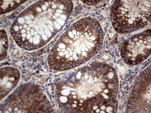 GARS / Glycyl tRNA Synthetase Antibody (clone OTI4G4)