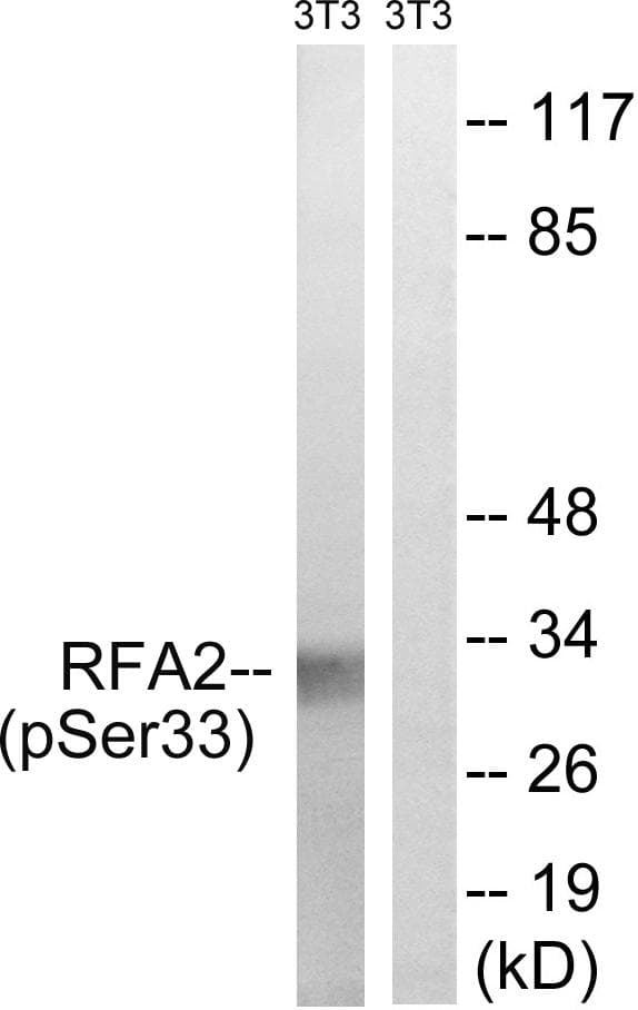 RPA2 / RFA2 / RPA34 Antibody (phospho-Ser33)