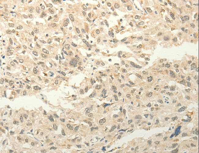 Polyclonal Rabbit anti-Human FZD8 / Frizzled 8 Antibody (IHC)