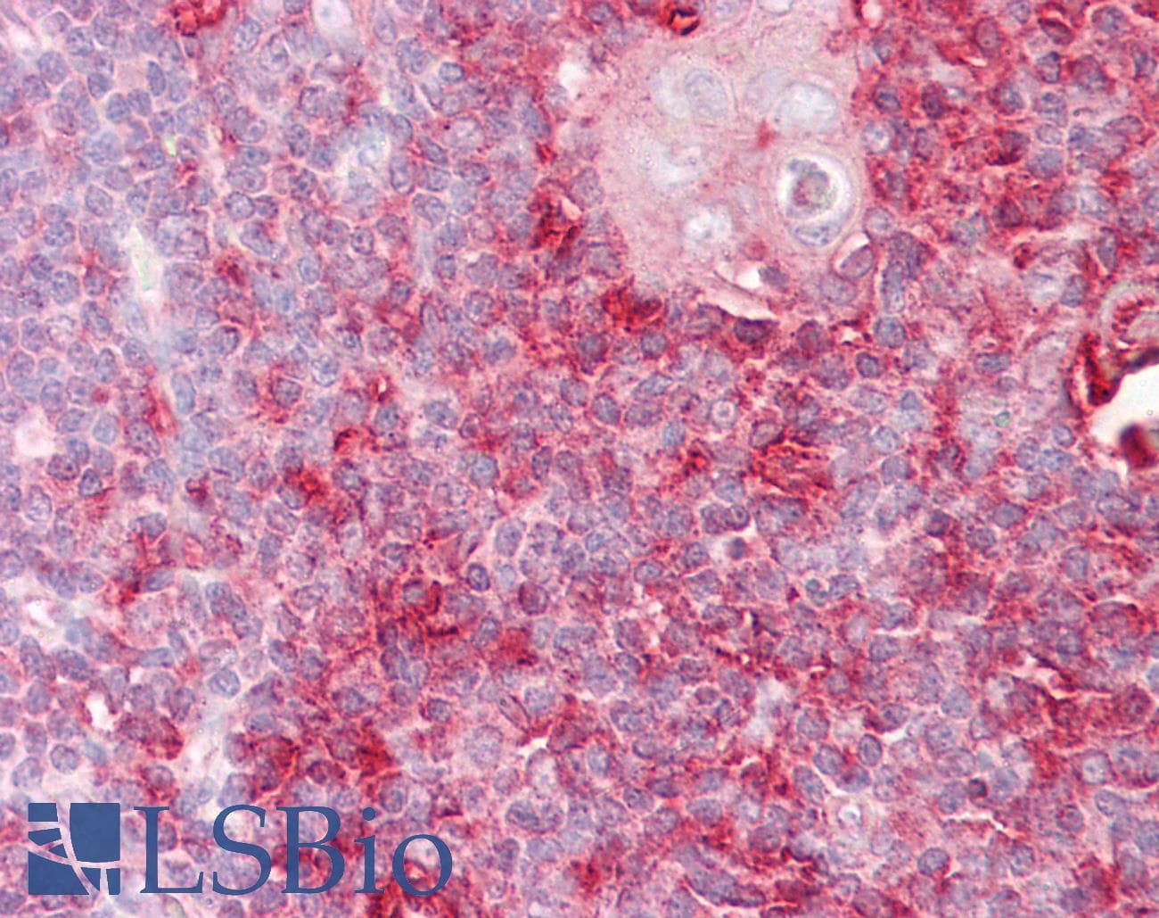 PathPlus™ Polyclonal Rabbit anti-Human IGSF4C / CADM4 Antibody (aa339-388, IHC, IF, WB)