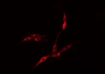 Polyclonal Rabbit anti-Human EIF3S5 / EIF3F Antibody (IHC, IF, WB)