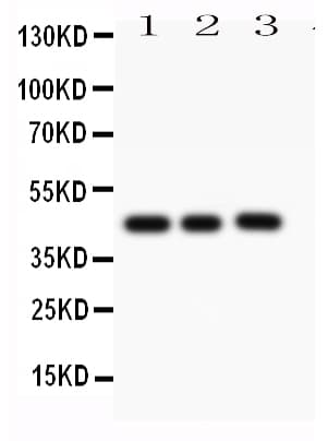CASP1 / Caspase 1 Antibody (aa249-262)