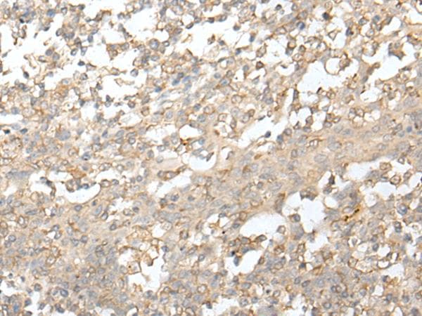 ATAC1 / ZZZ3 Antibody