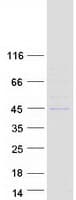 Human PNCK / CaMK1b Protein (Recombinant Myc-DDK (Flag))