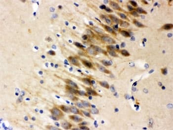 OTOF / Otoferlin Antibody