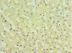 HSD11B1 / HSD11B Antibody (aa25-292)