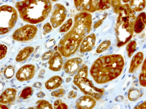 NME1 / NM23 Antibody (clone UMAB94)