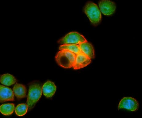 GPR49 / LGR5 Antibody (aa250-550, clone OTI2A2)