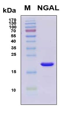 Human LCN2 / Lipocalin 2 / NGAL Protein (Recombinant 6His, N-terminus)