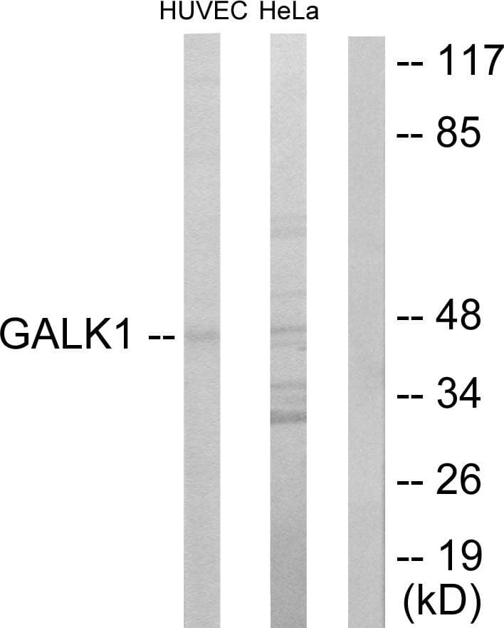 Polyclonal Rabbit anti-Human GALK1 / GK1 Antibody (WB)