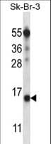 BTF3L4 Antibody (aa111-140)