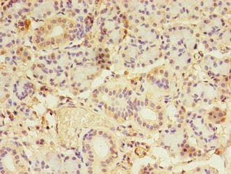 LDAH Antibody