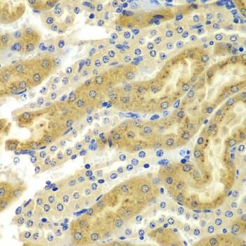 Polyclonal Rabbit anti-Human PAK2 Antibody (IHC, IF, WB)