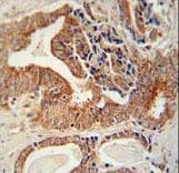 Polyclonal Rabbit anti-Human CRD-BP / ZBP1 / IGF2BP1 Antibody (aa508-534, IHC, WB)