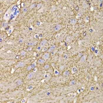 KCND3 / Kv4.3 Antibody
