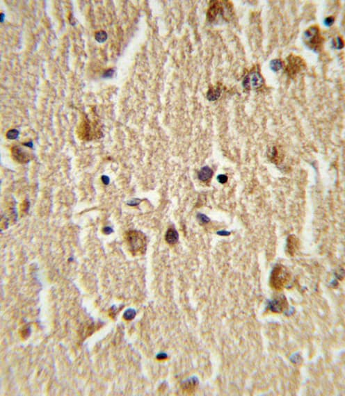 HSPA8 / HSC70 Antibody (aa82-110)