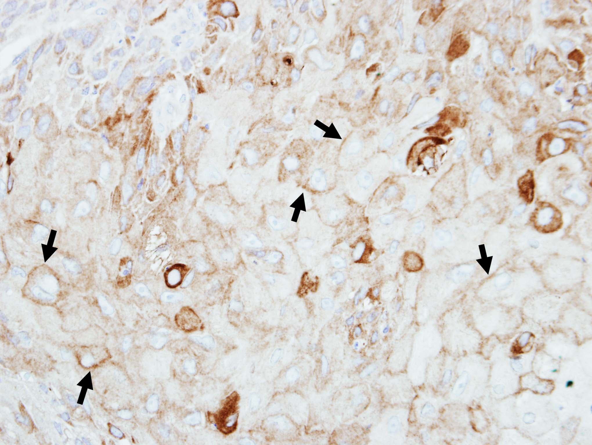 GIPC1 / GIPC Antibody (aa273-333)