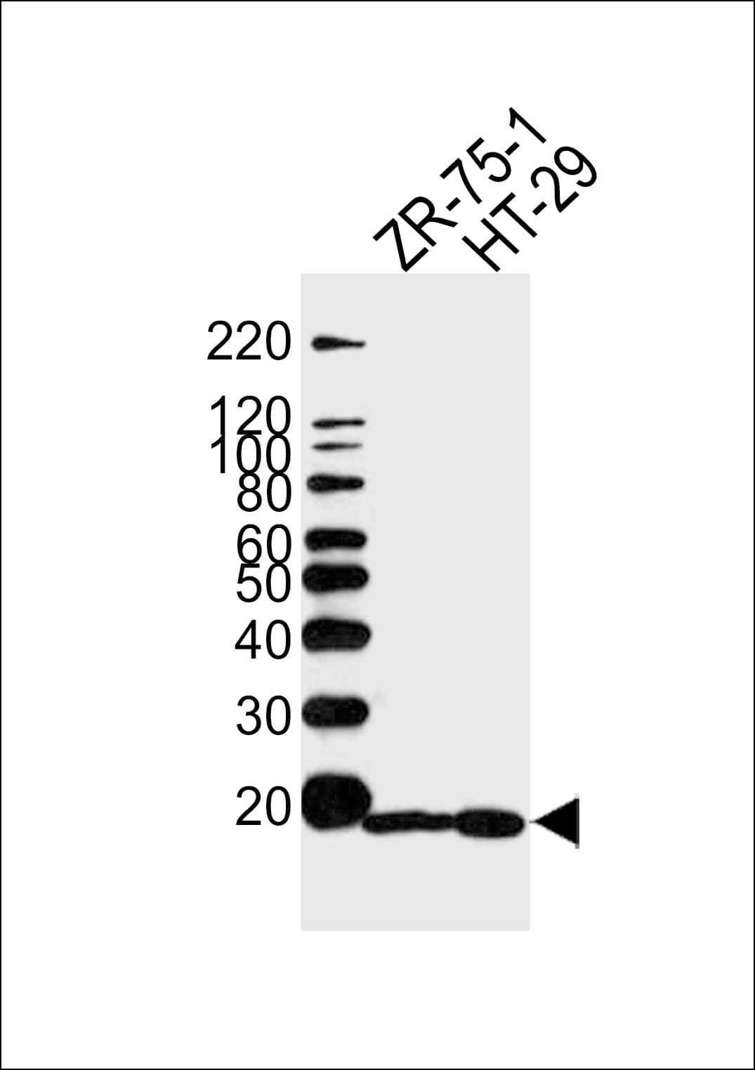 IHC-plus™ AGR2 Antibody (aa95-124)