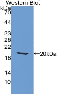 HBEGF / HB EGF Antibody (aa25-160)