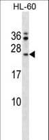 Polyclonal Rabbit anti-Human FAIM Antibody (aa65-93, WB)