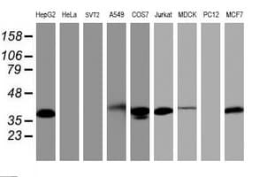 PDLIM2 / SLIM Antibody (clone OTI10C4)