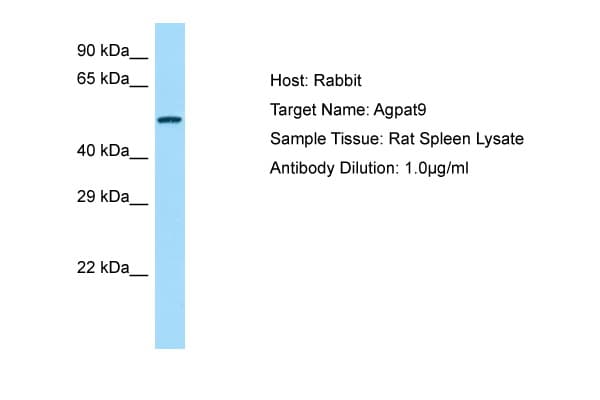 AGPAT9 / MAG1 Antibody (aa251-300)