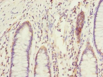 Polyclonal Rabbit anti-Human EIF2B2 Antibody (IHC)
