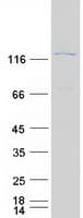 Human CLTCL1 / CHC22 Protein (Recombinant Myc-DDK (Flag))
