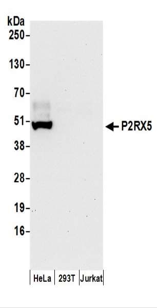 IHC-plus™ Polyclonal Rabbit anti-Human P2RX5 / P2X5 Antibody (aa372-422, IHC, WB)